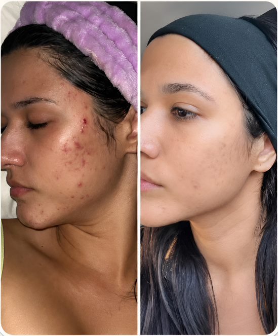 Customer-shared side-by-side skincare photos